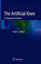 The Artificial Knee: An Ongoing Evolution