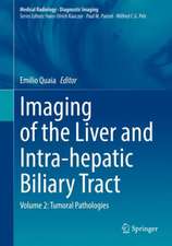 Imaging of the Liver and Intra-hepatic Biliary Tract: Volume 2: Tumoral Pathologies