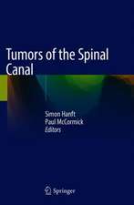 Tumors of the Spinal Canal