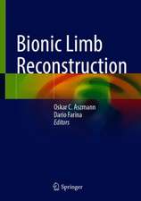 Bionic Limb Reconstruction