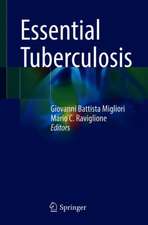 Essential Tuberculosis