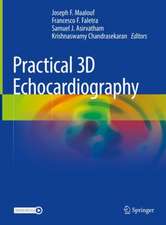 Practical 3D Echocardiography