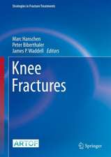 Knee Fractures