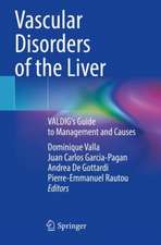 Vascular Disorders of the Liver 