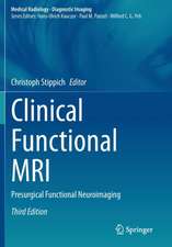 Clinical Functional MRI: Presurgical Functional Neuroimaging