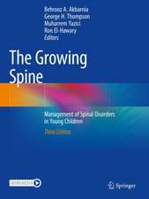 The Growing Spine: Management of Spinal Disorders in Young Children