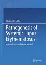 Pathogenesis of Systemic Lupus Erythematosus: Insights from Translational Research