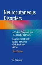 Neurocutaneous Disorders: A Clinical, Diagnostic and Therapeutic Approach