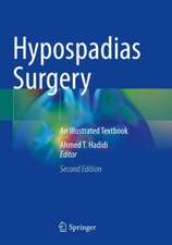 Hypospadias Surgery: An Illustrated Textbook