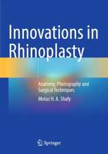 Innovations in Rhinoplasty: Anatomy, Photography and Surgical Techniques