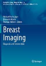 Breast Imaging: Diagnosis and Intervention