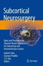 Subcortical Neurosurgery: Open and Parafascicular Channel-Based Approaches for Subcortical and Intraventricular Lesions