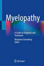 Myelopathy: A Guide to Diagnosis and Treatment