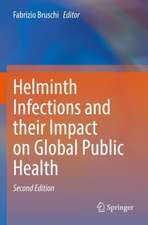 Helminth Infections and their Impact on Global Public Health