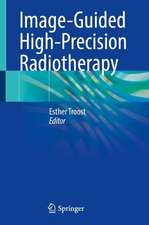 Image-Guided High-Precision Radiotherapy