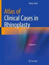 Atlas of Clinical Cases in Rhinoplasty: Volume II