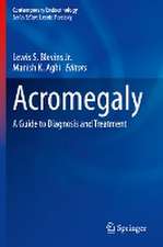 Acromegaly: A Guide to Diagnosis and Treatment