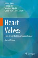 Heart Valves: From Design to Clinical Implantation