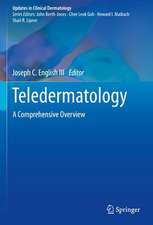 Teledermatology: A Comprehensive Overview