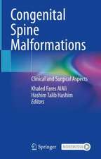 Congenital Spine Malformations: Clinical and Surgical Aspects