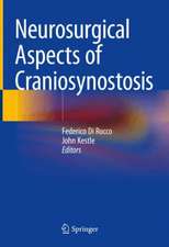 Neurosurgical Aspects of Craniosynostes