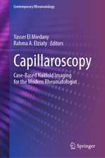 Capillaroscopy