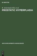 Prostatic Hyperplasia: Etiology, Surgical and Conservative Management