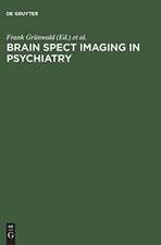 Brain SPECT Imaging in Psychiatry