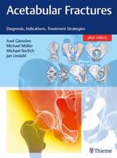 Acetabular Fractures – Diagnosis, Indications, Treatment Strategies