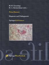 Prion Diseases: Diagnosis and Pathogenesis