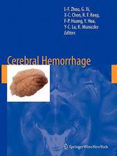 Cerebral Hemorrhage