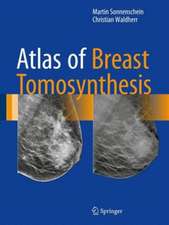 Atlas of Breast Tomosynthesis: Imaging Findings and Image-Guided Interventions