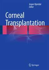 Corneal Transplantation