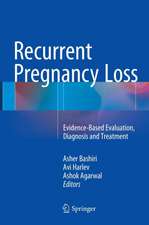 Recurrent Pregnancy Loss