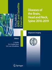 Diseases of the Brain, Head and Neck, Spine 2016-2019: Diagnostic Imaging