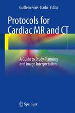 Protocols for Cardiac MR and CT: A Guide to Study Planning and Image Interpretation