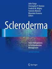 Scleroderma: From Pathogenesis to Comprehensive Management