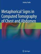 Metaphorical Signs in Computed Tomography of Chest and Abdomen