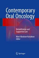 Contemporary Oral Oncology: Rehabilitation and Supportive Care