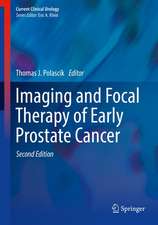 Imaging and Focal Therapy of Early Prostate Cancer