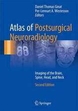 Atlas of Postsurgical Neuroradiology: Imaging of the Brain, Spine, Head, and Neck