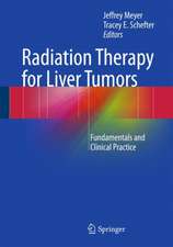 Radiation Therapy for Liver Tumors: Fundamentals and Clinical Practice