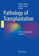 Pathology of Transplantation: A Practical Diagnostic Approach