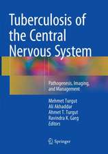 Tuberculosis of the Central Nervous System: Pathogenesis, Imaging, and Management