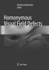 Homonymous Visual Field Defects