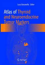 Atlas of Thyroid and Neuroendocrine Tumor Markers