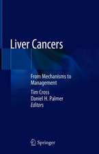 Liver Cancers: From Mechanisms to Management