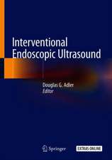 Interventional Endoscopic Ultrasound