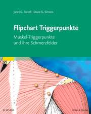 Flipchart Triggerpunkte