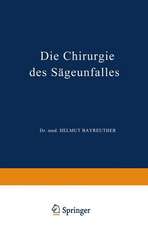 Die Chirurgie des Sägeunfalles: Klinische, Arbeitsphysiologische und Versicherungsrechtliche Untersuchungen